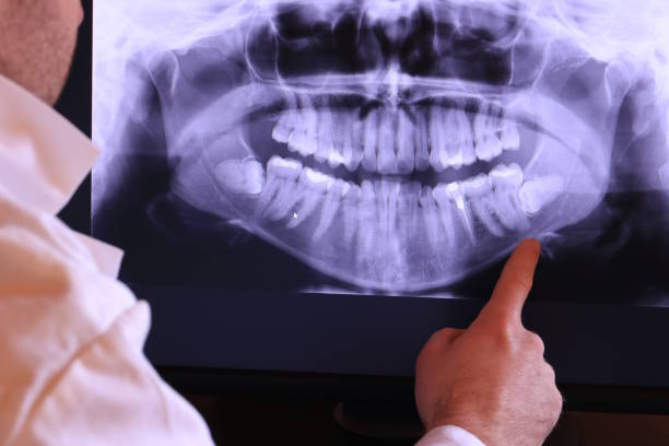 Best Emergency Wisdom Teeth Removal in Wewahitchka, FL