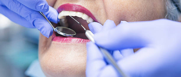 Best Emergency Dental Care for Broken or Chipped Teeth in Wewahitchka, FL